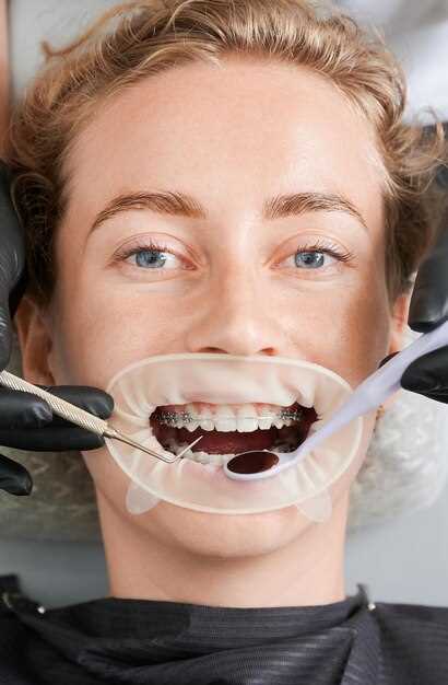 Интересные факты об ортодонтии: что вы не знали о брекетах