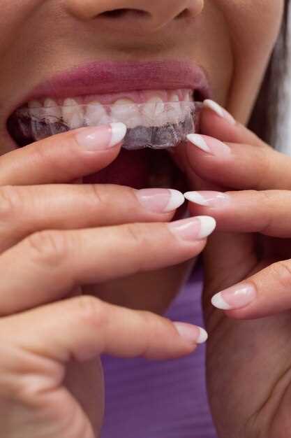 Как избежать боли и дискомфорта при ношении брекетов: рекомендации стоматологов