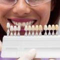 Лучшие материалы для коронок и мостов в стоматологии – обзор и сравнение