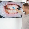 Отбеливание зубов – новейшие технологии и эффективные процедуры