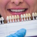 Имплантация зубов – плюсы и минусы, как выбрать между имплантами и съемными протезами