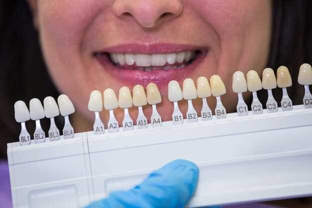 Плюсы и минусы имплантации зубов: как выбрать между имплантами и съемными протезами