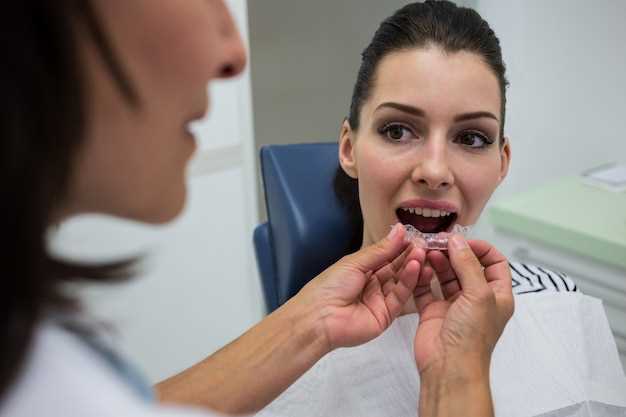 Фториды и их роль в профилактике зубного налета