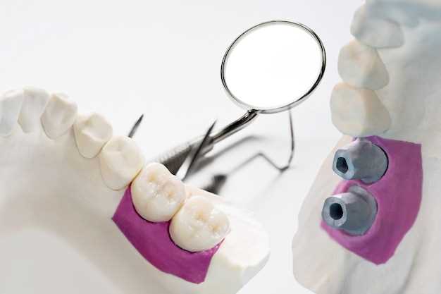 Преимущества и необходимость протезирования зубов – полный гид для здоровой и красивой улыбки