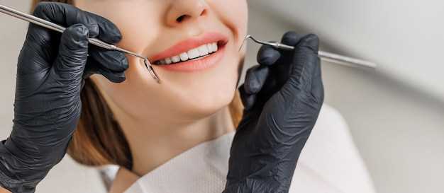 Процедуры стоматологии для создания улыбки Голливуда: отбеливание, виниры, имплантация
