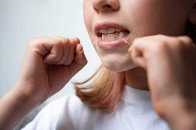 Миф 2: Стоматологический клей разрушает зубную эмаль