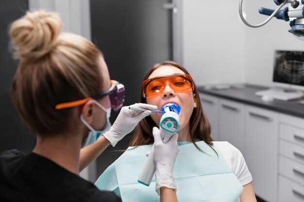 Стоматологические виниры и накладки: техники и преимущества реставрации зубов