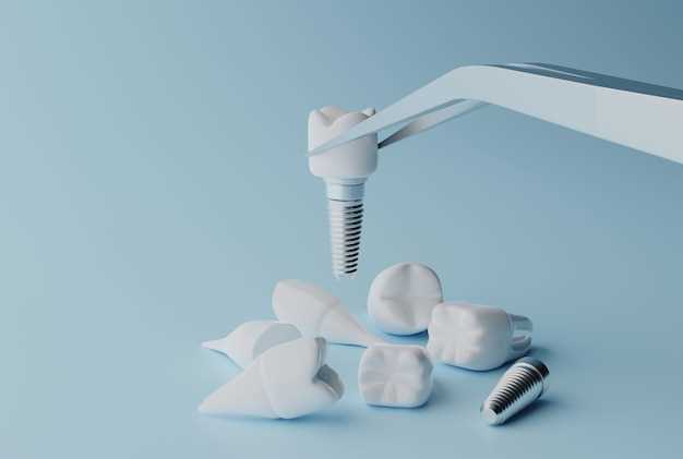 Виниры и накладки: инновационные решения для эстетической стоматологии