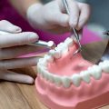 Восстановление утраченных зубов с помощью коронок и мостов – преимущества и рекомендации