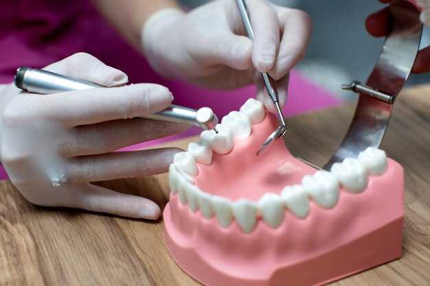 Восстановление утраченных зубов с помощью коронок и мостов – преимущества и рекомендации