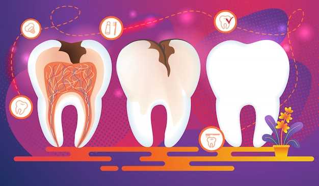 Вредные привычки, которые вредят здоровью зубов и десен: как избавиться от них